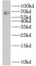 Western Blot Suppression of Tumorigenicity 7 Antibody - BSA Free