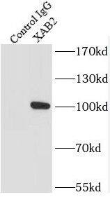 Immunoprecipitation: XAB2 Antibody - BSA Free [NBP3-45543] - IP Result of anti-XAB2 (IP:, 4ug; Detection: 1:200) with K-562 cells lysate 3200ug.