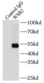 Immunoprecipitation: WSB2 Antibody - BSA Free [NBP3-45545] - IP Result of anti-WSB2 (IP:, 3ug; Detection: 1:800) with mouse kidney tissue lysate 6000ug.