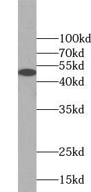 Western Blot: WIRE Antibody - BSA Free [NBP3-45548] - Mouse brain tissue were subjected to SDS PAGE followed by western blot with (WIRE antibody) at dilution of 1:500