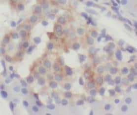 Immunohistochemistry WFDC3 Antibody - BSA Free