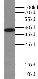 Western Blot: WDR92 Antibody - BSA Free [NBP3-45553] - Mouse testis tissue were subjected to SDS PAGE followed by western blot with (WDR92 Antibody) at dilution of 1:300