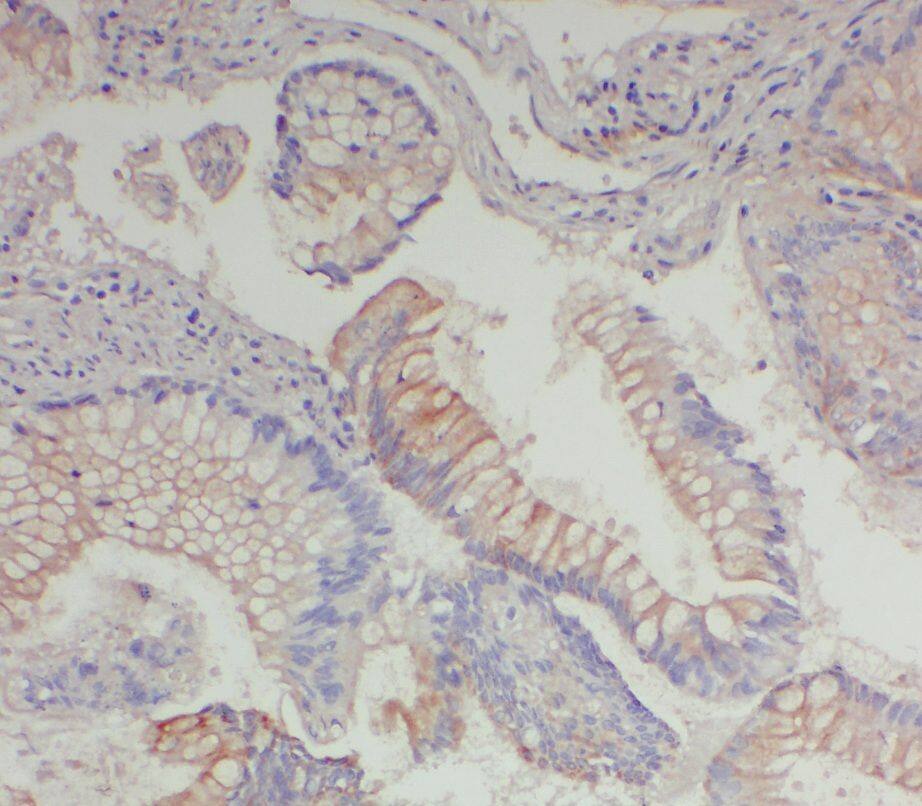 Immunohistochemistry: WDR92 Antibody - BSA Free [NBP3-45553] - Immunohistochemistry of paraffin-embedded human testis tissue slide using (WDR92 Antibody) at dilution of 1:50