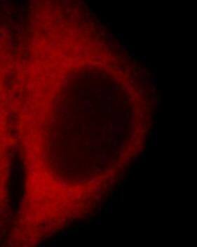 Immunocytochemistry/ Immunofluorescence: WDR81 Antibody - BSA Free [NBP3-45554] - Immunofluorescent analysis of HepG2 cells using  (WDR81 antibody) at dilution of 1:25 and Rhodamine-Goat anti-Rabbit IgG