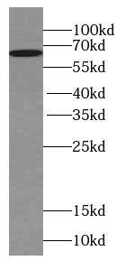 Western Blot: WDR81 Antibody - BSA Free [NBP3-45554] - Mouse brain tissue were subjected to SDS PAGE followed by western blot with (WDR81 Antibody) at dilution of 1:300