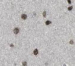 Immunohistochemistry: WDR81 Antibody - BSA Free [NBP3-45554] - Immunohistochemistry of paraffin-embedded human cerebellum tissue slide using (WDR81 Antibody) at dilution of 1:50