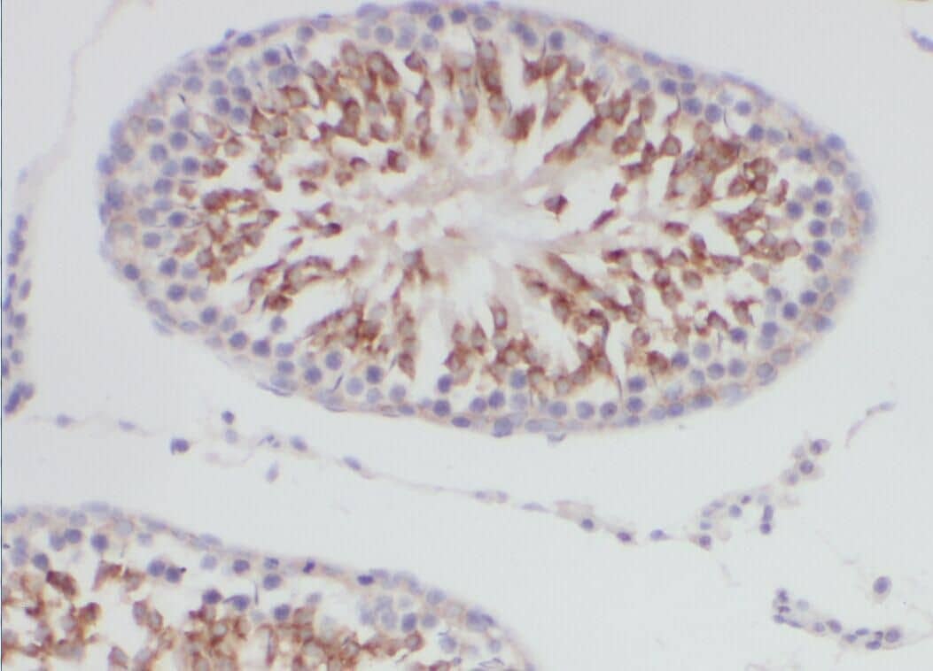 Immunohistochemistry DCAF12 Antibody - BSA Free