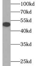 Western Blot DCAF12 Antibody - BSA Free