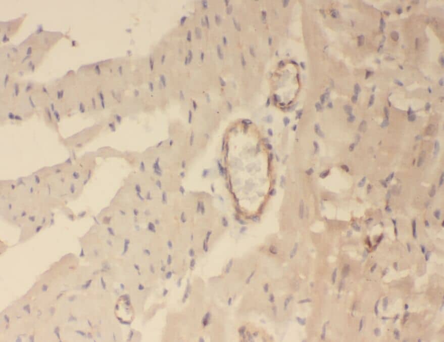 Immunohistochemistry: WDR37 Antibody - BSA Free [NBP3-45562] - Immunohistochemistry of paraffin-embedded human heart using (WDR37 antibody) at dilution of 1:50