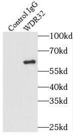 Immunoprecipitation DCAF10 Antibody - BSA Free