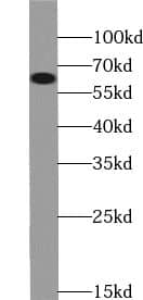 Western Blot: DCAF10 Antibody - BSA Free [NBP3-45563] - HeLa cells were subjected to SDS PAGE followed by western blot with (DCAF10 antibody) at dilution of 1:800