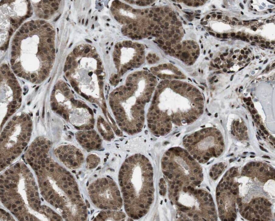 Immunohistochemistry: DCAF10 Antibody - BSA Free [NBP3-45563] - Immunohistochemistry of paraffin-embedded human testis using (DCAF10 antibody) at dilution of 1:100