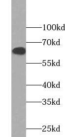 Western Blot: WDR20 Antibody - BSA Free [NBP3-45566] - HeLa cells were subjected to SDS PAGE followed by western blot with (WDR20 Antibody) at dilution of 1:1000