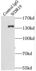 Immunoprecipitation: WDR19 Antibody - BSA Free [NBP3-45567] - IP Result of anti-WDR19/IFT144 (IP:, 4ug; Detection: 1:500) with HEK-293 cells lysate 3200ug.