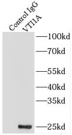 Immunoprecipitation: VTI1A Antibody - BSA Free [NBP3-45577] - IP Result of anti-VTI1A (IP:, 3ug; Detection: 1:1000) with MCF-7 cells lysate 520ug.