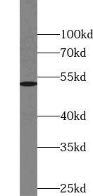 Western Blot: VRK3 Antibody - BSA Free [NBP3-45580] - HL-60 cells were subjected to SDS PAGE followed by western blot with (VRK3 antibody) at dilution of 1:300
