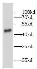 Western Blot: VRK2 Antibody - BSA Free [NBP3-45581] - K-562 cells were subjected to SDS PAGE followed by western blot with (VRK2 antibody) at dilution of 1:500