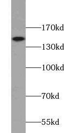 Western Blot VPS8 Antibody - BSA Free