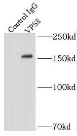 Immunoprecipitation VPS8 Antibody - BSA Free
