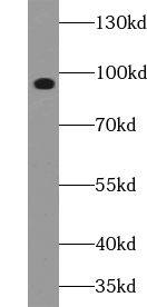 Western Blot: VPS41 Antibody - BSA Free [NBP3-45588] - HepG2 cells were subjected to SDS PAGE followed by western blot with (VPS41 antibody) at dilution of 1:400