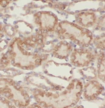 Immunohistochemistry VPS33B Antibody - BSA Free