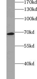 Western Blot VPS33A Antibody - BSA Free