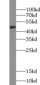 Western Blot: VPREB3 Antibody - BSA Free [NBP3-45592] - Human spleen tissue were subjected to SDS PAGE followed by western blot with (VPREB3 antibody) at dilution of 1:400
