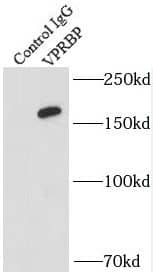 Immunoprecipitation VprBP Antibody - BSA Free