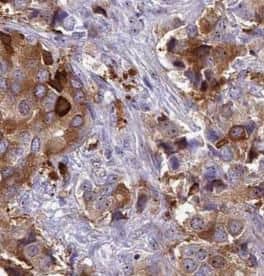 Immunohistochemistry VprBP Antibody - BSA Free