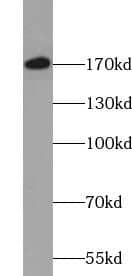 Western Blot VprBP Antibody - BSA Free