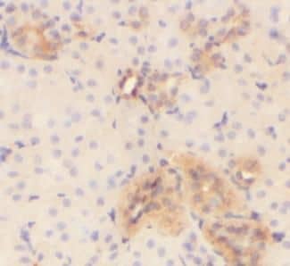 Immunohistochemistry: VMO1 Antibody - BSA Free [NBP3-45595] - Immunohistochemistry of paraffin-embedded human kidney tissue slide using (VMO1 Antibody) at dilution of 1:50