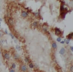 Immunohistochemistry VMA21 Antibody - BSA Free