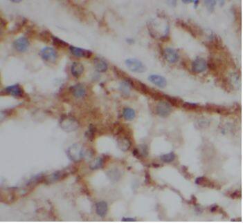 Immunohistochemistry: VIPR1/VPAC1 Antibody - BSA Free [NBP3-45597] - Immunohistochemistry of paraffin-embedded human kidney tissue slide using (VIPR1/VPAC1 Antibody) at dilution of 1:50