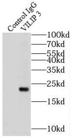 Immunoprecipitation: VILIP3 Antibody - BSA Free [NBP3-45598] - IP Result of anti-VILIP 3 (IP:, 3ug; Detection: 1:1000) with mouse brain tissue lysate 4000ug.
