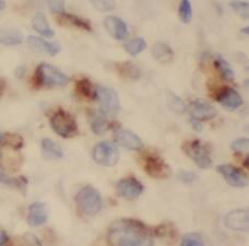 Immunohistochemistry VILIP3 Antibody - BSA Free