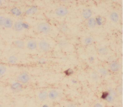Immunohistochemistry: VEZT Antibody - BSA Free [NBP3-45599] - Immunohistochemistry of paraffin-embedded human brain using (VEZT antibody) at dilution of 1:100