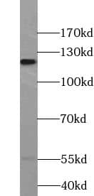 Western Blot: VEZT Antibody - BSA Free [NBP3-45599] - Human brain tissue were subjected to SDS PAGE followed by western blot with (VEZT antibody) at dilution of 1:500