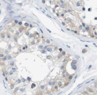 Immunohistochemistry: VDAC3 Antibody - BSA Free [NBP3-45601] - Immunohistochemistry of paraffin-embedded human testis using (VDAC3 antibody) at dilution of 1:50