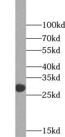 Western Blot: VDAC3 Antibody - BSA Free [NBP3-45601] - Mouse testis tissue were subjected to SDS PAGE followed by western blot with (VDAC3 antibody) at dilution of 1:300
