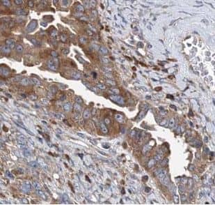 Immunohistochemistry VARS2 Antibody - BSA Free