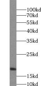 Western Blot: UXT Antibody - BSA Free [NBP3-45607] - HeLa cells were subjected to SDS PAGE followed by western blot with (UXT antibody) at dilution of 1:400