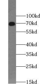 Western Blot: UTP6 Antibody - BSA Free [NBP3-45608] - HeLa cells were subjected to SDS PAGE followed by western blot with (UTP6 Antibody) at dilution of 1:300