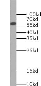 Western Blot: UTP15 Antibody - BSA Free [NBP3-45611] - MCF7 cells were subjected to SDS PAGE followed by western blot with (UTP15 antibody) at dilution of 1:300