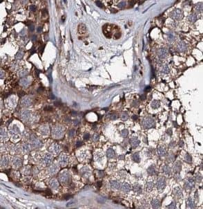 Immunohistochemistry: USP50 Antibody - BSA Free [NBP3-45614] - Immunohistochemistry of paraffin-embedded human testis using (USP50antibody) at dilution of 1:50