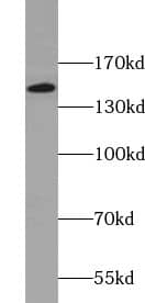 Western Blot: USP42 Antibody - BSA Free [NBP3-45617] - Mouse brain tissue were subjected to SDS PAGE followed by western blot with (USP42 antibody) at dilution of 1:300