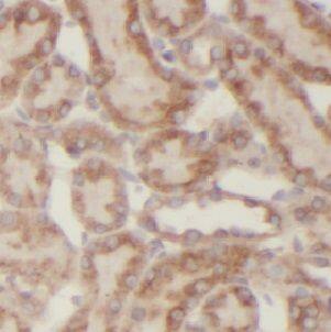 Immunohistochemistry: USP33 Antibody - BSA Free [NBP3-45623] - Immunohistochemistry of paraffin-embedded human kidney slide using (USP33 Antibody) at dilution of 1:50