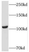 Western Blot: USP33 Antibody - BSA Free [NBP3-45623] - HEK-293 cells were subjected to SDS PAGE followed by western blot with (USP33 antibody) at dilution of 1:300