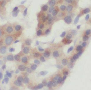 Immunohistochemistry: USP32 Antibody - BSA Free [NBP3-45624] - Immunohistochemistry of paraffin-embedded human pancreas using (USP32 antibody) at dilution of 1:100