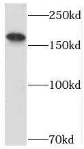 Western Blot: USP32 Antibody - BSA Free [NBP3-45624] - HeLa cells were subjected to SDS PAGE followed by western blot with (USP32 antibody) at dilution of 1:400