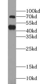 Western Blot: USP18 Antibody - BSA Free [NBP3-45627] - Western Blot result of USP18 antibody with MCF-7 cells .